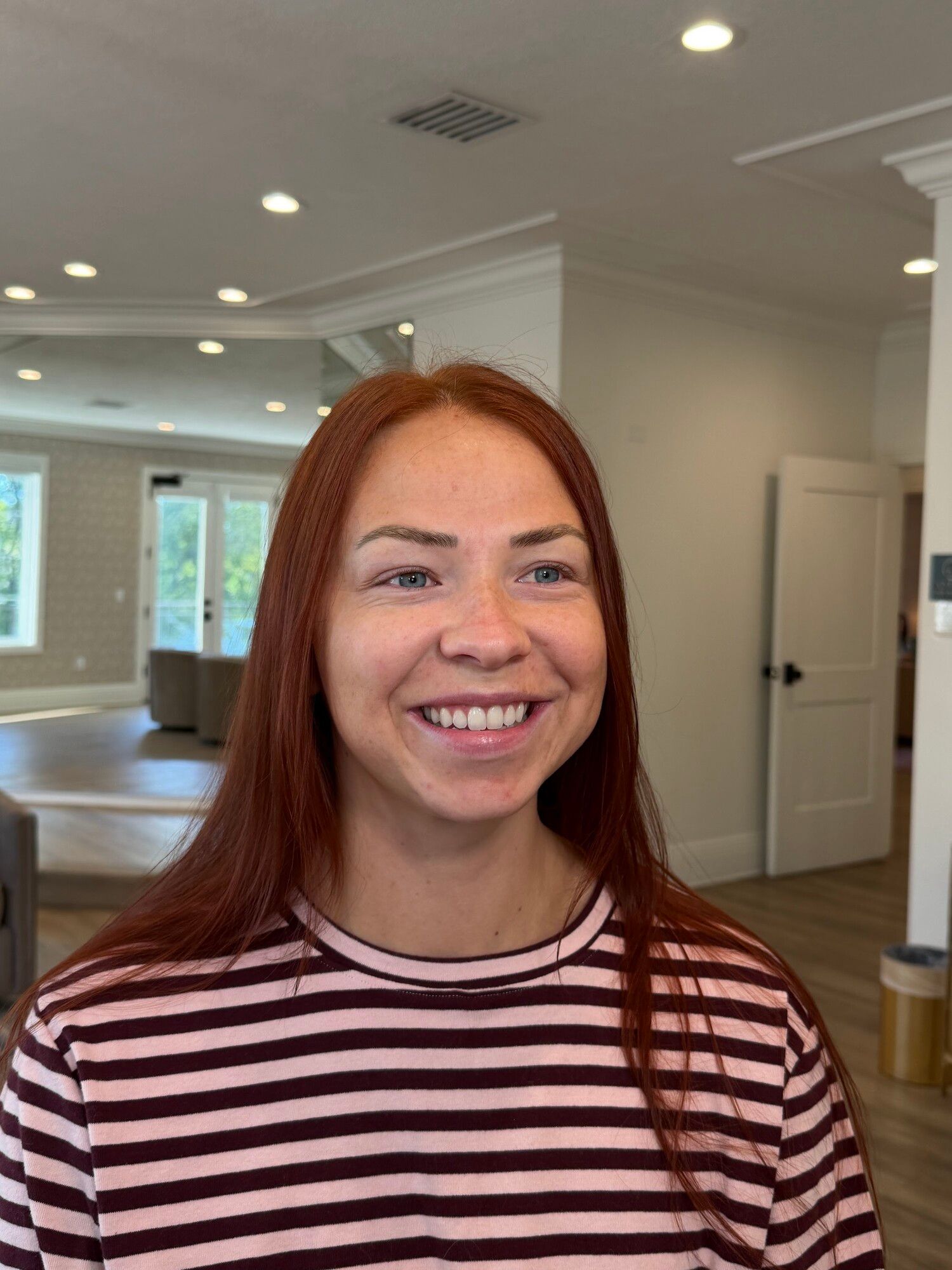 Before: a red-haired woman in a striped top with bare skin